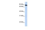 TAF1C Polyclonal Antibody