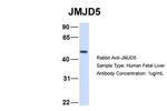 JMJD5 Polyclonal Antibody