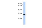 Bisphosphoglycerate mutase Polyclonal Antibody