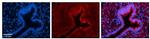 PHLDA2 Antibody in Immunohistochemistry (Paraffin) (IHC (P))