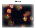 TFPI2 Polyclonal Antibody