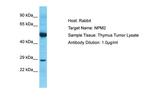 NPM2 Polyclonal Antibody