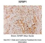 IGF2BP1 Polyclonal Antibody