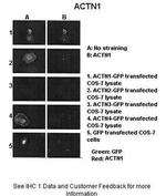 alpha Actinin 1 Polyclonal Antibody