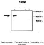 alpha Actinin 1 Antibody in Western Blot (WB)