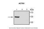 alpha Actinin 1 Antibody in Western Blot (WB)