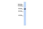alpha Actinin 1 Antibody in Western Blot (WB)