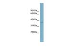 SPAG4L Polyclonal Antibody