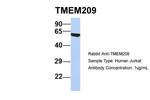 TMEM209 Antibody in Western Blot (WB)