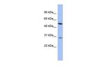 KRT75 Polyclonal Antibody