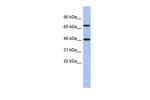 SLAIN2 Polyclonal Antibody
