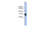 PSMD9 Polyclonal Antibody