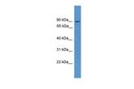NCKIPSD Polyclonal Antibody