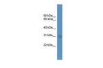 SNAP29 Polyclonal Antibody