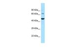 SLC6A11 Polyclonal Antibody