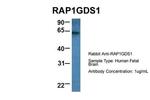 RAP1GDS1 Polyclonal Antibody