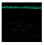 ALDH3A1 Polyclonal Antibody