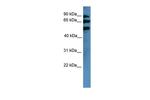 BBS2 Polyclonal Antibody