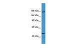 BTBD12 Polyclonal Antibody