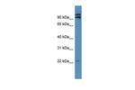 MRPL49 Polyclonal Antibody