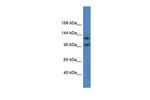 LONP2 Polyclonal Antibody