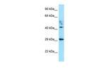 ATCAY Polyclonal Antibody