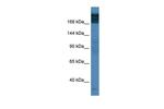 TPR Polyclonal Antibody