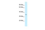 PDLIM7 Polyclonal Antibody