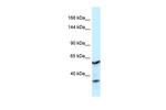 CNTROB Polyclonal Antibody