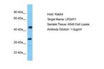 LPGAT1 Polyclonal Antibody
