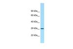 ACY3 Polyclonal Antibody