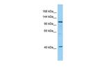DHTKD1 Polyclonal Antibody