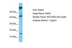 SDHC Antibody in Western Blot (WB)