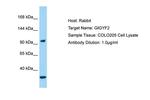 GIGYF2 Polyclonal Antibody
