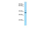 DEF6 Antibody in Western Blot (WB)