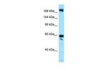 WNK2 Polyclonal Antibody