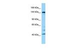 ITSN2 Polyclonal Antibody