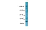 RPL27A Polyclonal Antibody