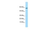 TREH Polyclonal Antibody