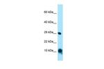CISD1 Polyclonal Antibody