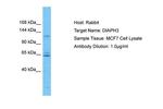 DIAPH3 Polyclonal Antibody
