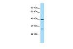 PISD Polyclonal Antibody