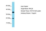 RPL28 Polyclonal Antibody