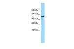 GMIP Polyclonal Antibody