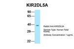 KIR2DL5A Antibody in Western Blot (WB)