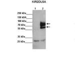 KIR2DL5A Polyclonal Antibody