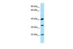 KTI12 Polyclonal Antibody