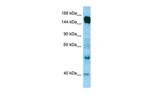 RAPGEF6 Polyclonal Antibody