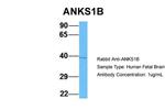 ANKS1B Polyclonal Antibody