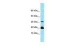 MYLPF Polyclonal Antibody
